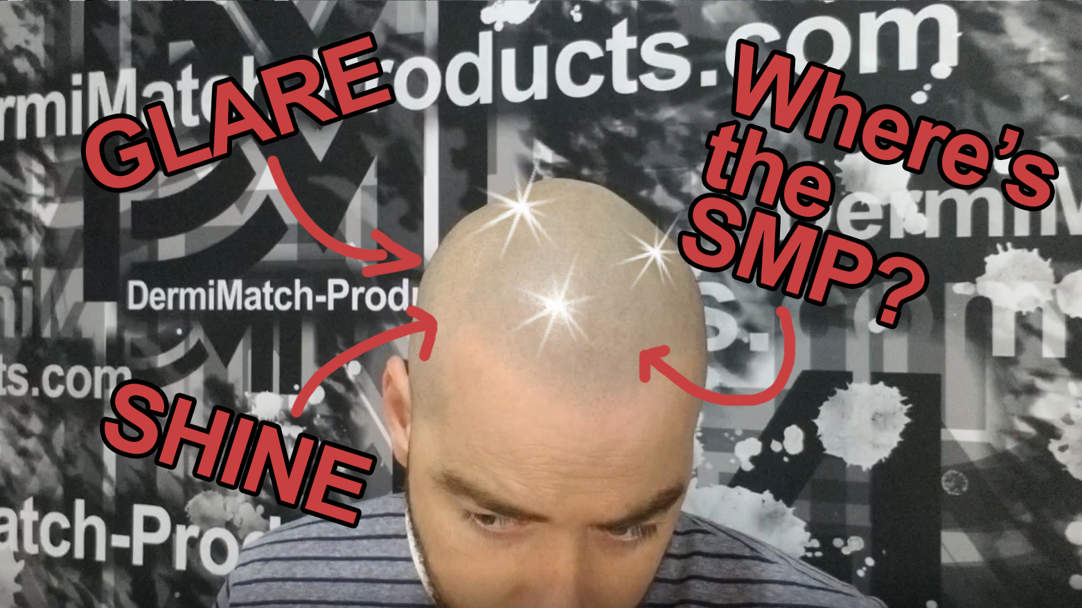matte scalp