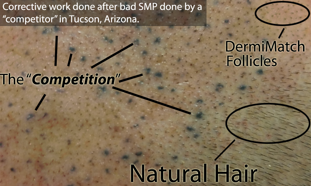 bad scalp micropigmentation SMP